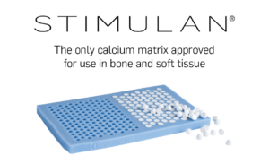 Calcium Testing Machine Using Foot Diabetic Foot - Biocomposites